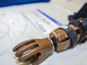 Estrategia “Con-Unidad” avanza con entrega de Prótesis a personas con discapacidad